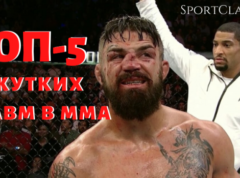 ТОП-5 травм мма